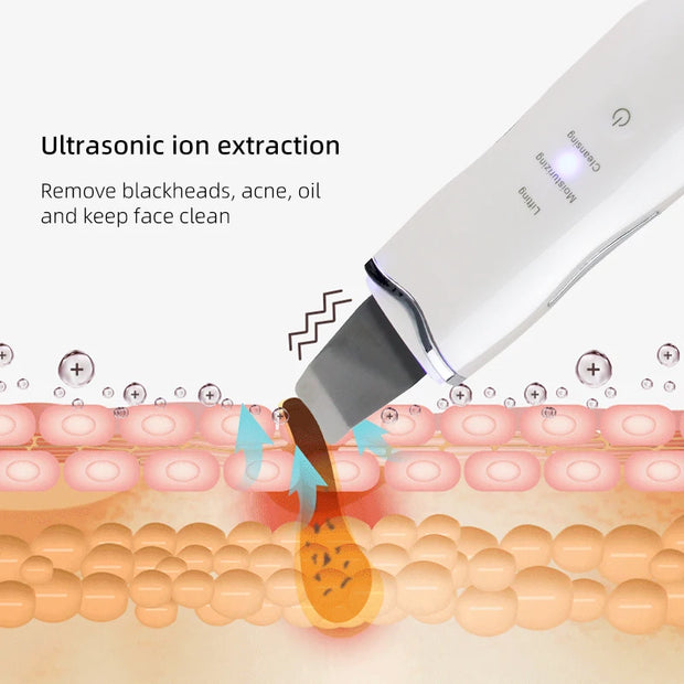 Professional Ultrasonic Skin Scrubber for Blackhead Removal and Facial Lifting