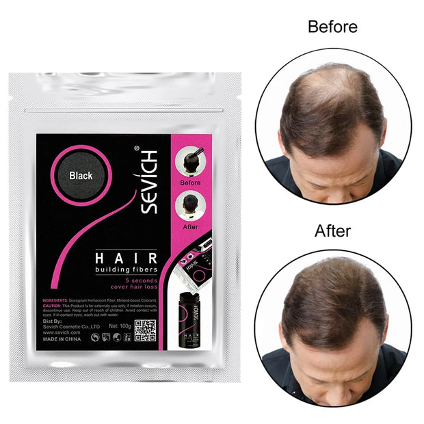 SEVICH Regrowth Keratin Hair Powder for Thinning Hair - 100g Refill-Pack - Available in 10 Colors