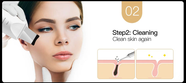 Professional Ultrasonic Skin Scrubber for Blackhead Removal and Facial Lifting