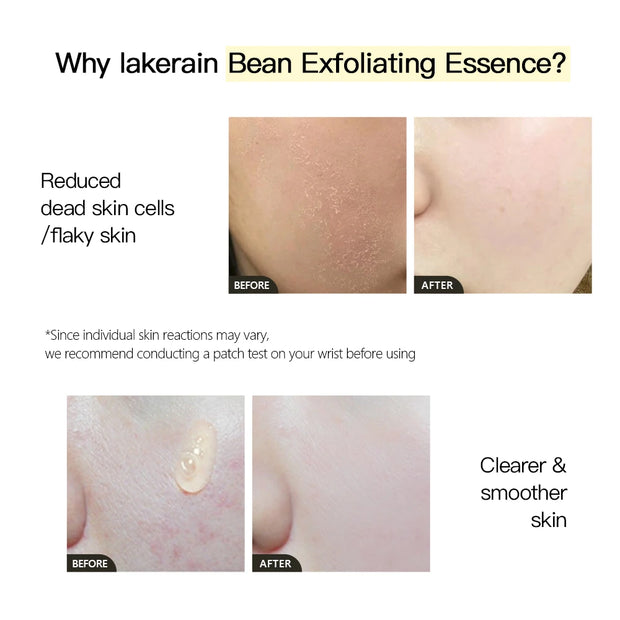 LAKERAIN 30ml Hydrating Bean Exfoliating Facial Serum, Gentle and Reduces Dead Skin Cells