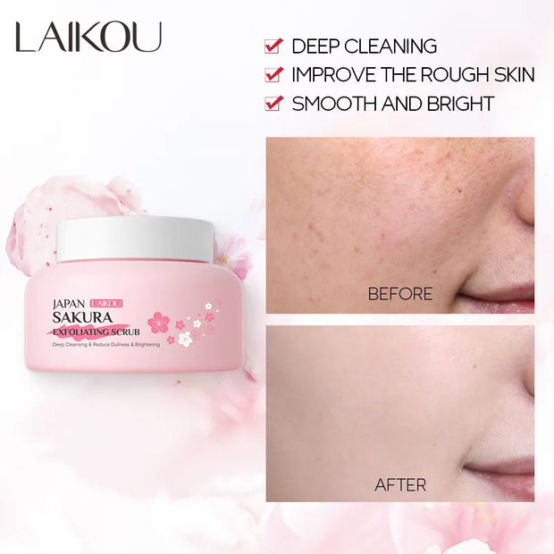 LAIKOU Sakura Peeling Exfoliating Scrub Gel for Face and Body, Blackhead and Dead Skin Remover, 100g