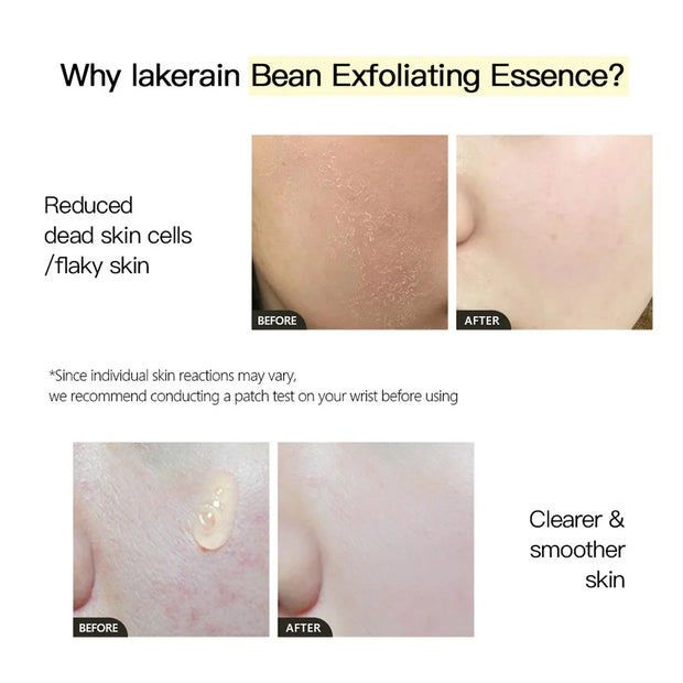 LAKERAIN 30ml Hydrating Bean Exfoliating Facial Serum, Gentle and Reduces Dead Skin Cells